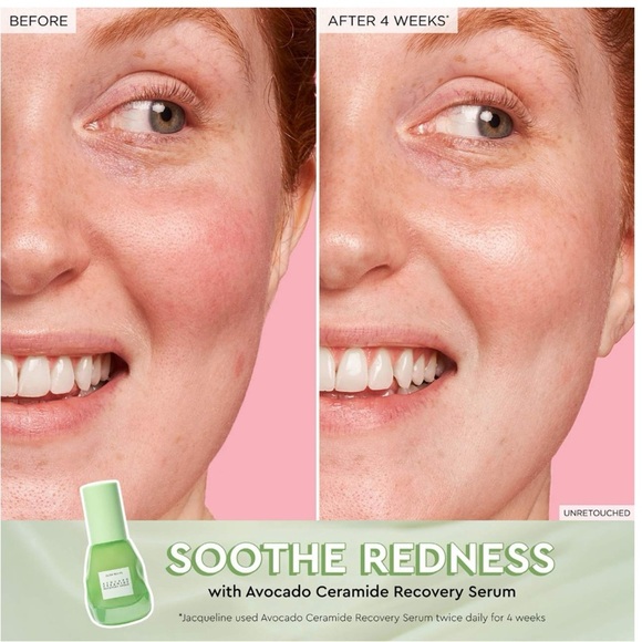 Glow Recipe Avocado Ceramide Recovery Serum - Picture 3 of 6